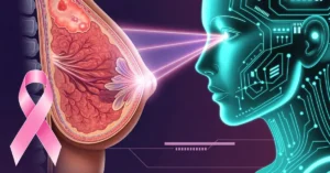 تشخیص سرطان سینه با هوش مصنوعی